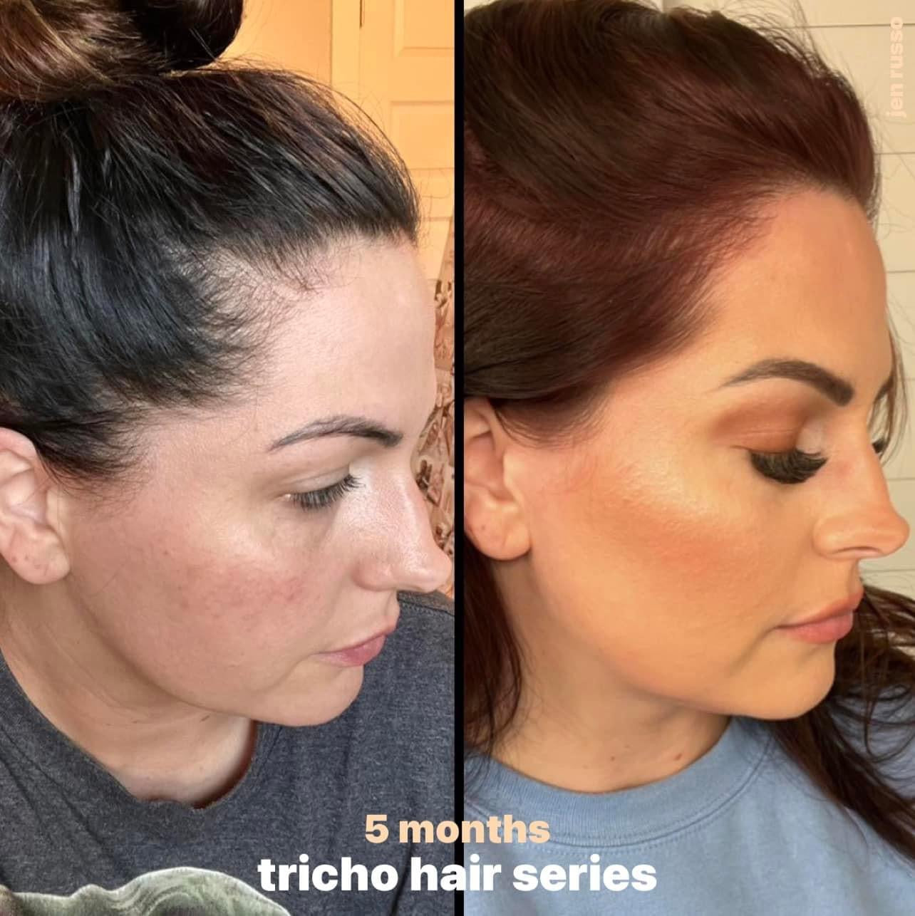 Tricho-Pro X Haircare duo